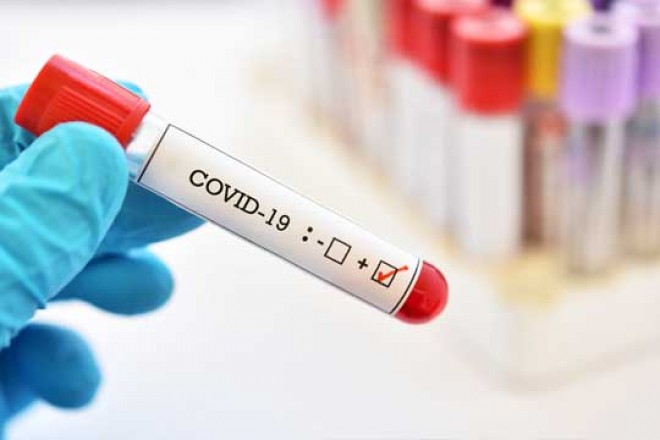 AP: 1933 people have tested positive for Coronavirus 